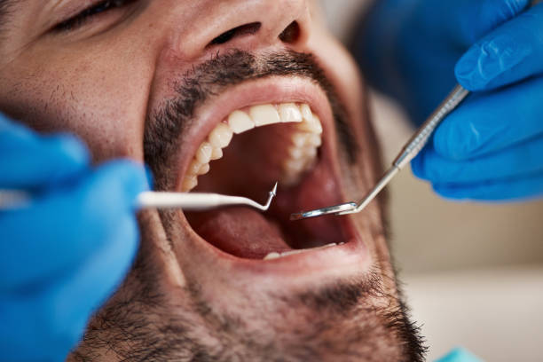 Best Sedation Dentistry  in Continental, OH
